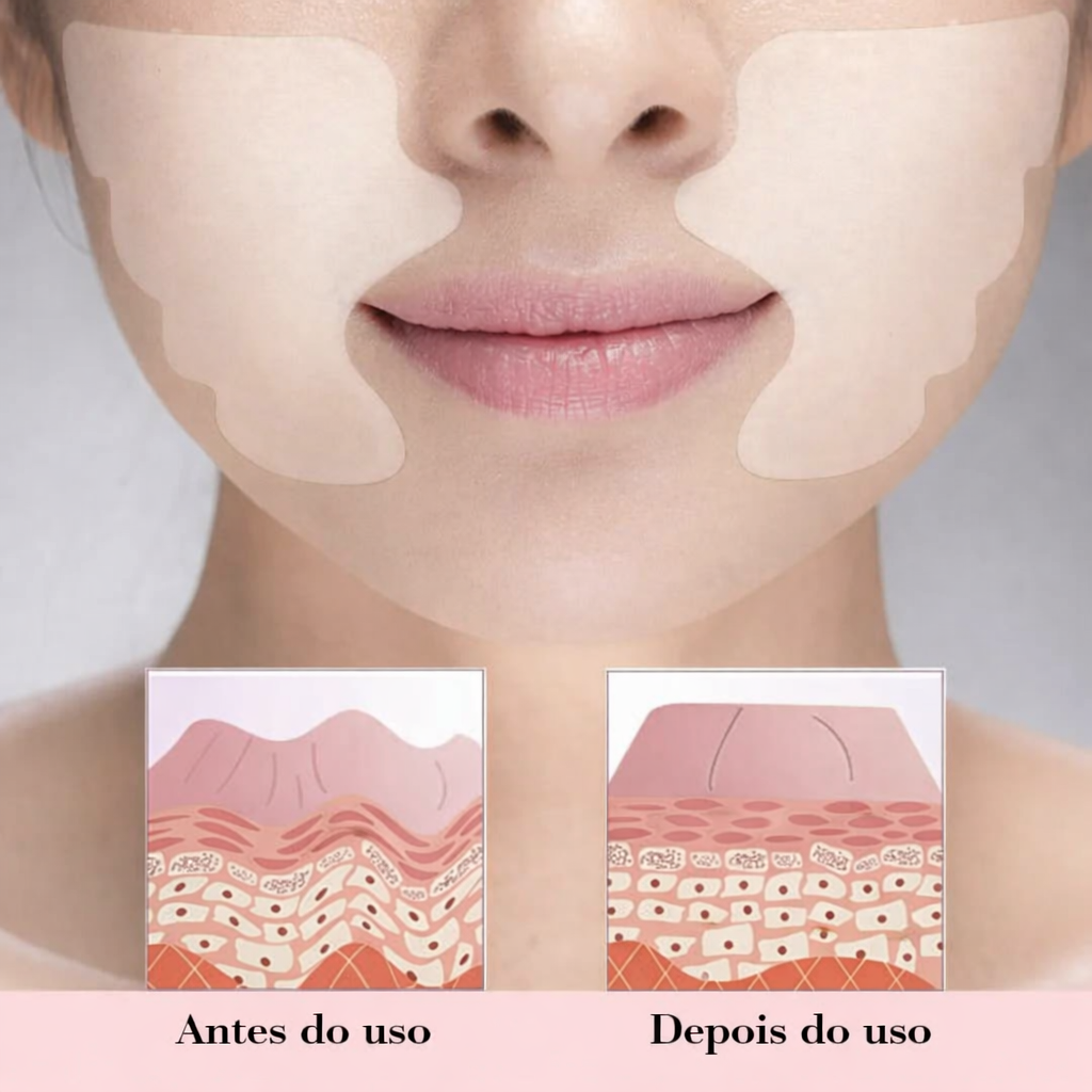 New Botox - Livre de Rugas e Linhas de Expressões