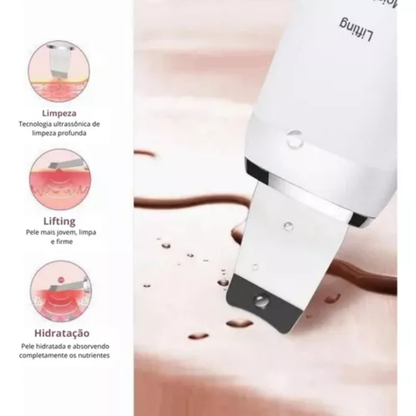 Aparelho de Peeling Esfoliante Ultrassônico Limpeza Facial Profunda Remoção de Cravos Antirrugas Sonic Skin