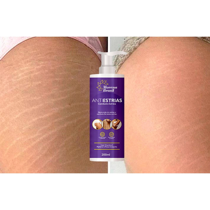 Creme Anti-Estrias - Diga Adeus às Estrias! Previne Novas Estrias & Reforça a Elasticidade Da Pele